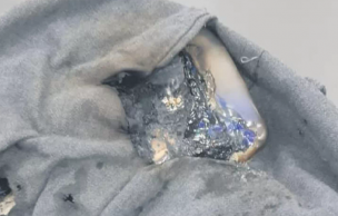 Celular se incendió en bolsillo de escolar de 8° básico en Santiago