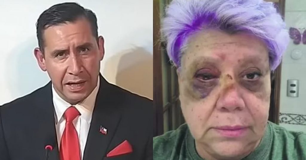 Pastor Soto se refirió a accidente que sufrió Patricia Maldonado: habló de ‘justicia divina’