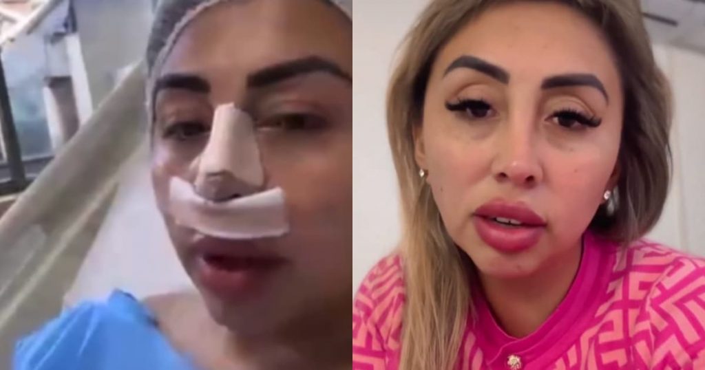 “Yo también soy persona, también siento”: Naya Fácil reaccionó a odiosas críticas por someterse a rinoplastia