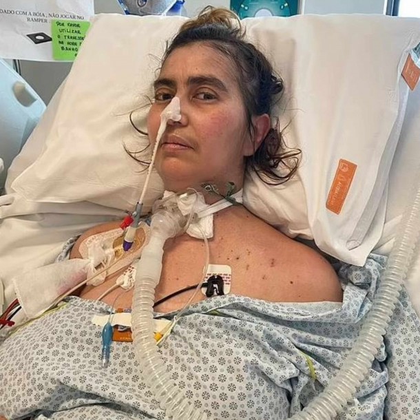Brasileña comió pesto artesanal y su “cuerpo dejó de funcionar”