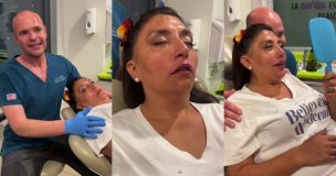 Pincoya se sometió a intervención facial: 