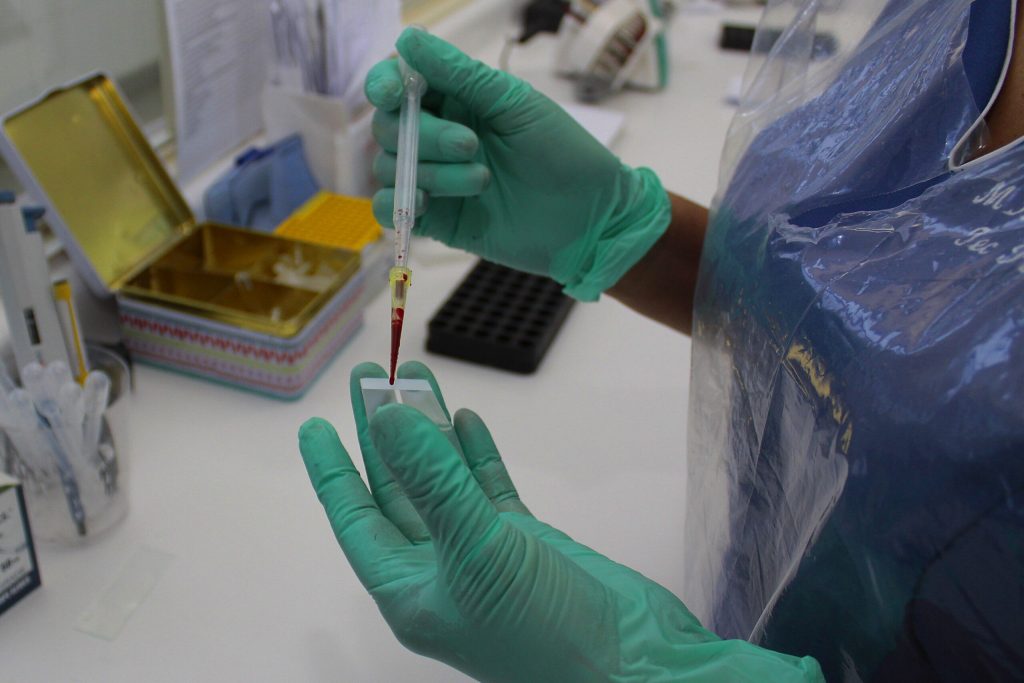 Etiopía activa protocolos de emergencia por brote de mortal virus de Marburgo