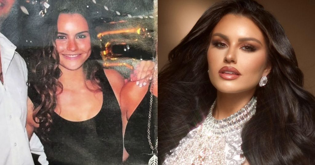 ¿Cirugía o maquillaje? Emilia Dides aclara los rumores de cirugía: “No inventen”