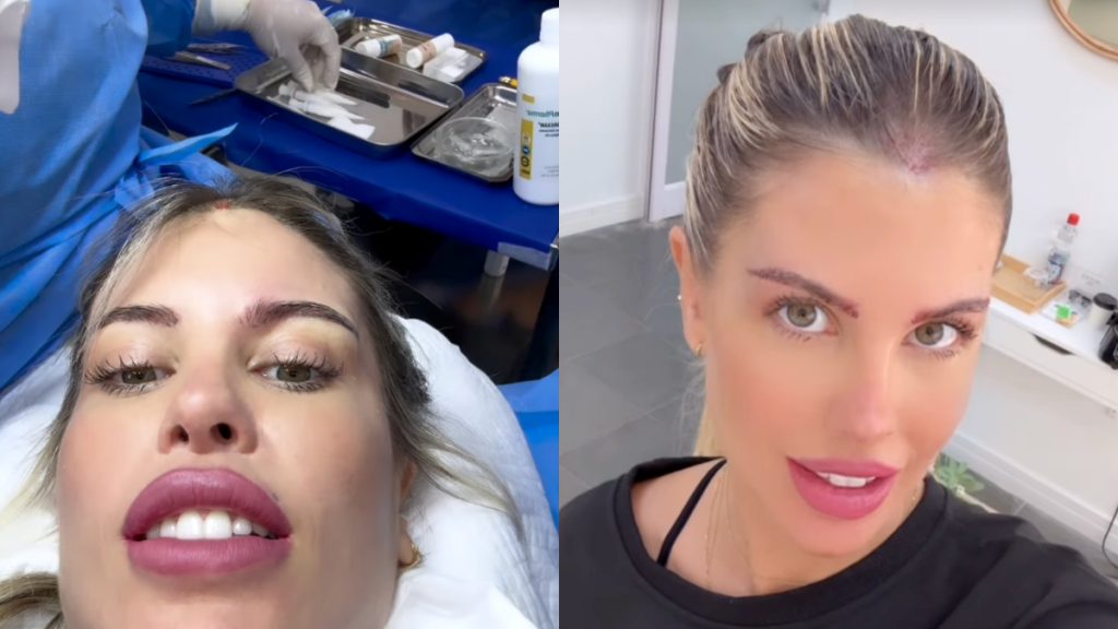 Coté López sorprende con nuevo retoque estético y responde a las críticas: “Me molesta, así que me lo hago”