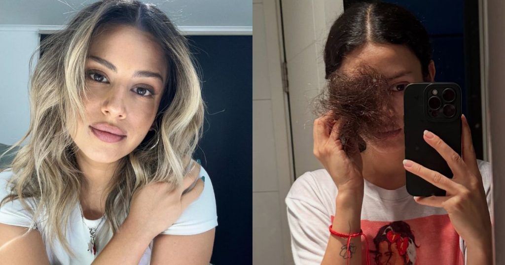 Karla Melo y su dura reflexión tras perder el cabello por quimioterapia: “Emocionalmente es duro”