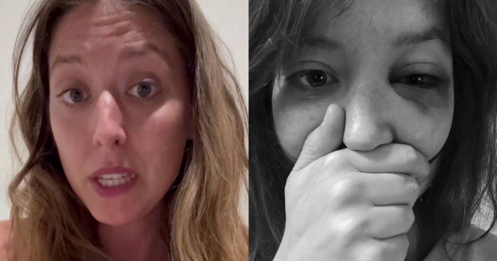 Actriz Magdalena Gelsam acusa a exactor de Mega de violencia física: “Él me violentaba recurrentemente”