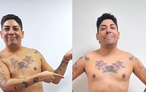 “Más feliz, más seguro”: Botota Fox revela los resultados de su cirugía estética tras dos meses