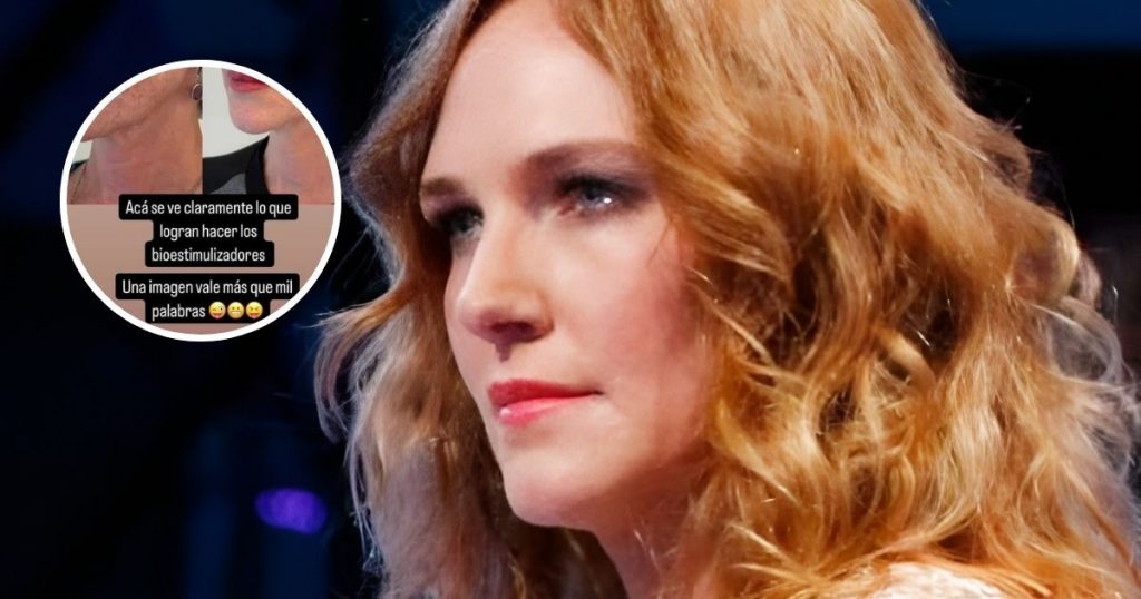 Catalina Pulido muestra impactante antes y después tras intervención estética: “Una imagen vale más que mil palabras”