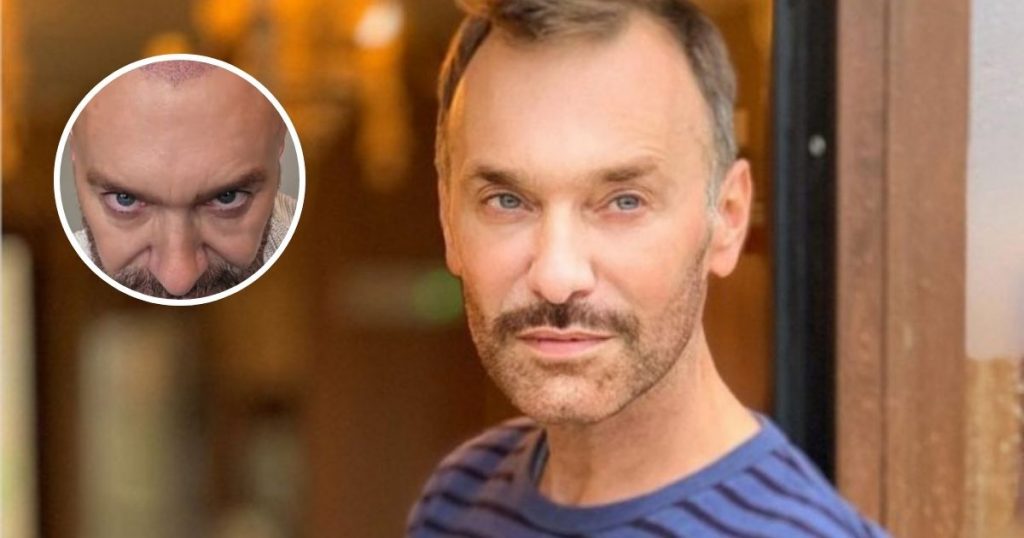 Jordi Castell mostró resultados de su implante capilar: contó cuánto costó y cómo fue el postoperatorio