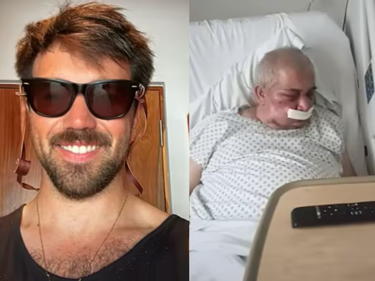 Brutal golpiza a conserje de 70 años en Vitacura: podría perder la visión de un ojo