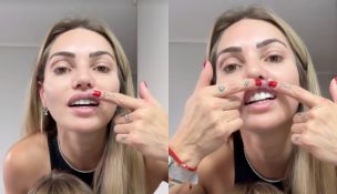 Faloon Larraguibel muestra dura lesión tras la final de “Palabra de Honor”: “Heridas de guerra”