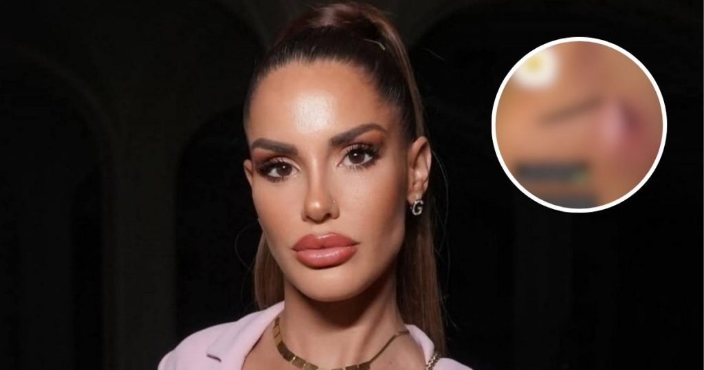 Gala Caldirola muestra grave secuela de reality extremo: “No apto para sensibles”