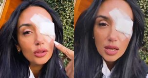 Pamela Díaz preocupó a fans tras intervención por grave problema en su ojo