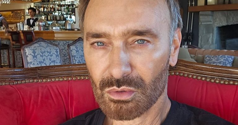 Jordi Castell muestra el impactante antes y después de su implante capilar