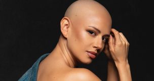 Karla Melo conmovió al revelar su batalla contra el cáncer: