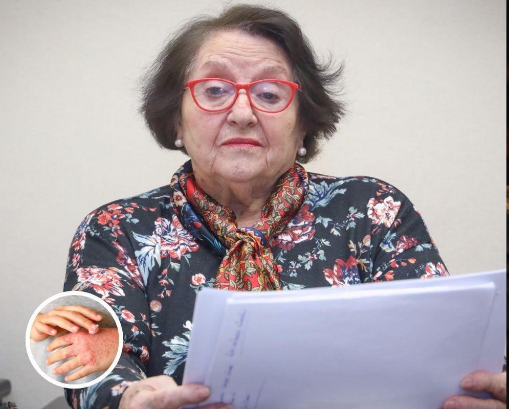 Diputada Cordero exige al Minsal incluir la dermatitis atópica en el GES y la Ley Ricarte Soto