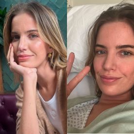 “Estuve internada”: Millaray Viera rompe el silencio sobre su delicada salud