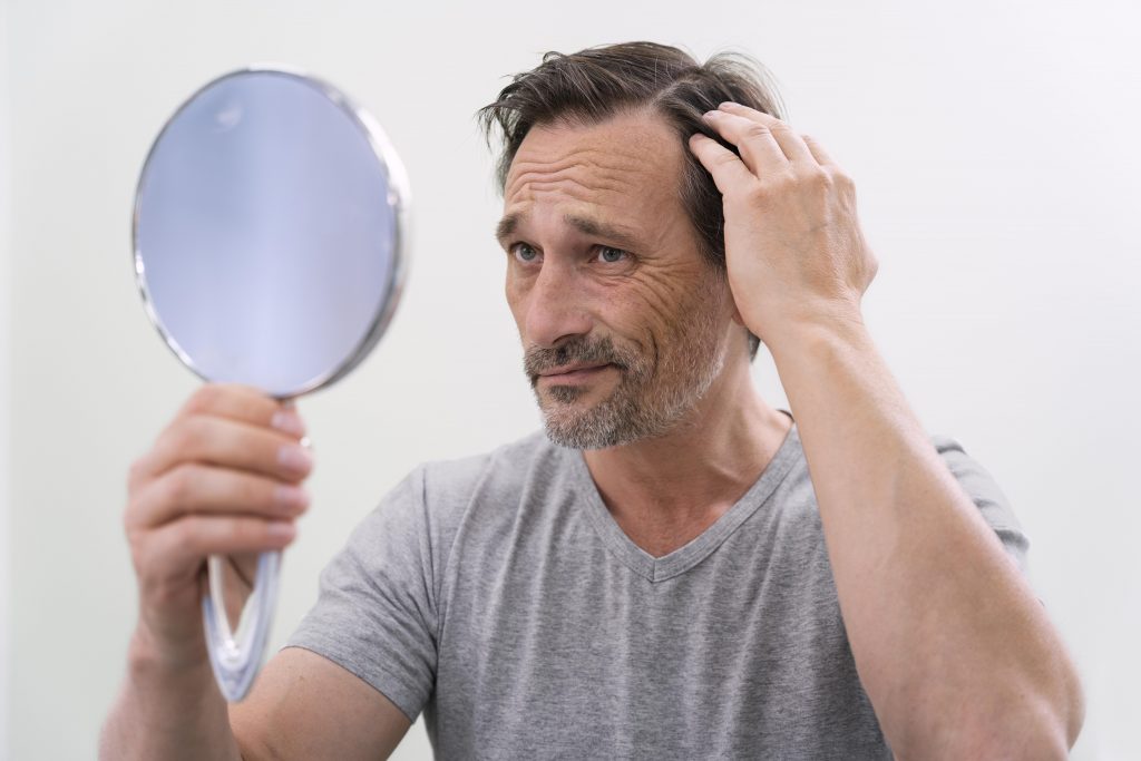 Calvicie: cómo enfrentar la caída del cabello