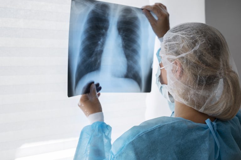 Cáncer de pulmón en Chile preocupa por alta mortalidad y diagnóstico tardío
