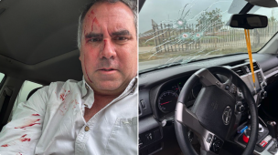 Atacan a balazos a candidato presidencial de Perú en Lima