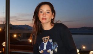 ¡Impactante! Kel Calderón revela los dolorosos moretones que dejó su accidente