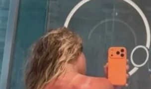 Preocupación en el Australian Open: tenista mostró quemaduras solares en su espalda