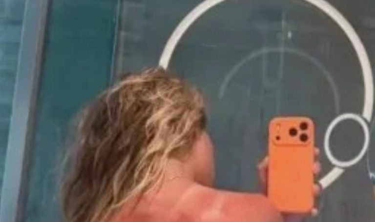 Preocupación en el Australian Open: tenista mostró quemaduras solares en su espalda