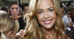 Actriz Denise Richards impacta con radical cambio tras cirugía estética: su antes y después sorprende