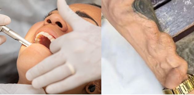 Dentista explica riesgos de infección dental tras comentado caso viral en redes sociales