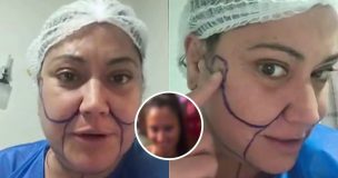 Denisse Campos enseña su look 'irreconocible' tras cirugías: 