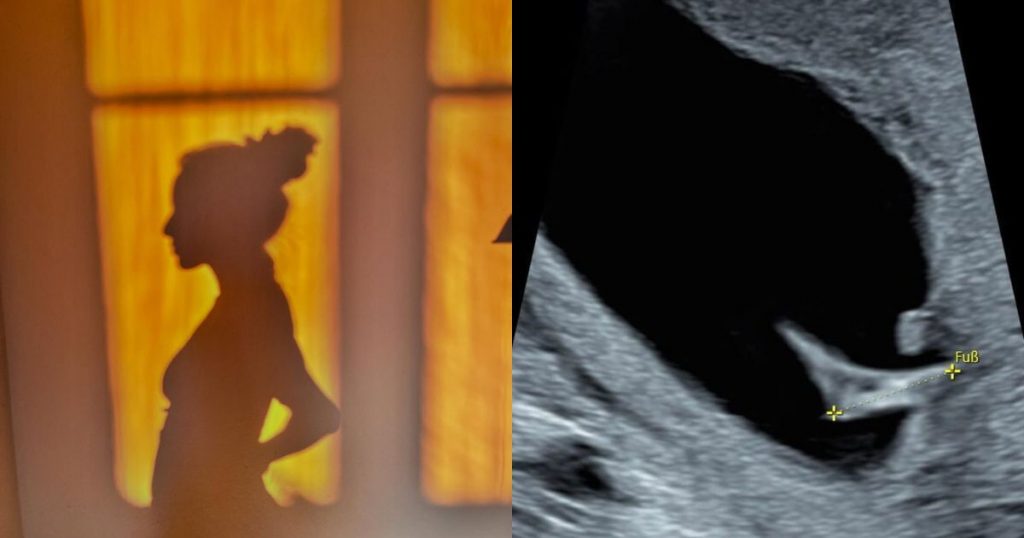 Actriz chilena anuncia su segundo embarazo con emotivo mensaje en redes