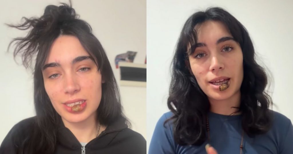 La joven que descubrió que tenía sífilis tras morderse el labio: su historia se volvió viral