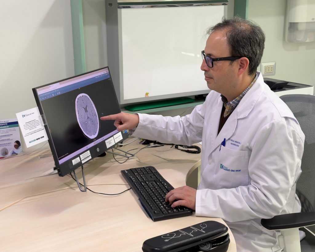 Salud cerebral: los hábitos que ayudan a reducir el riesgo de accidentes cerebrovasculares y demencia