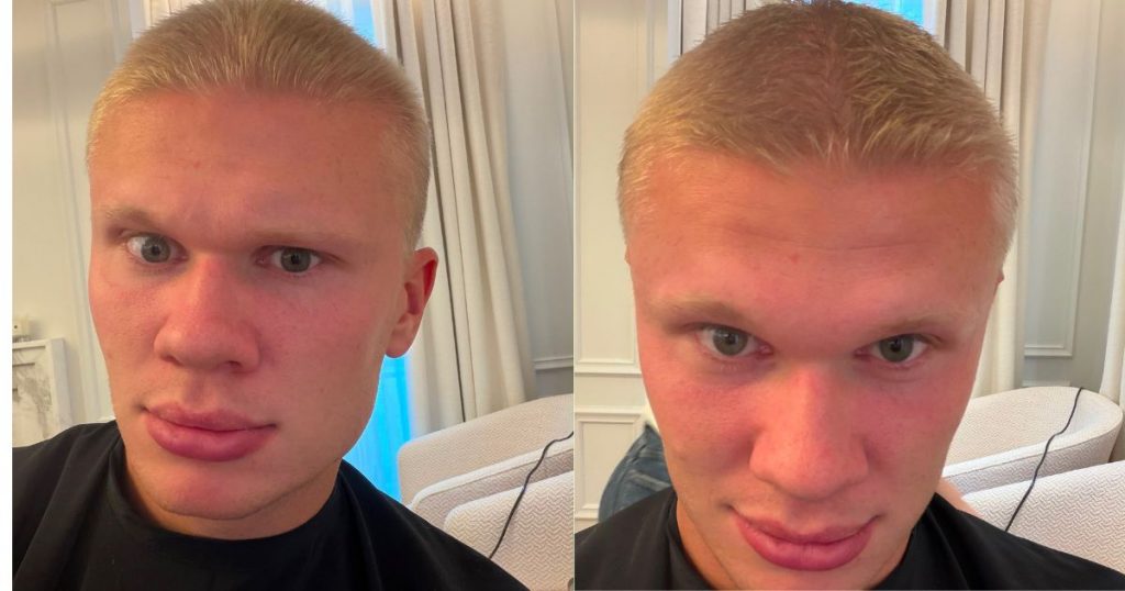 Erling Haaland sorprende con radical cambio de look antes de una nueva temporada