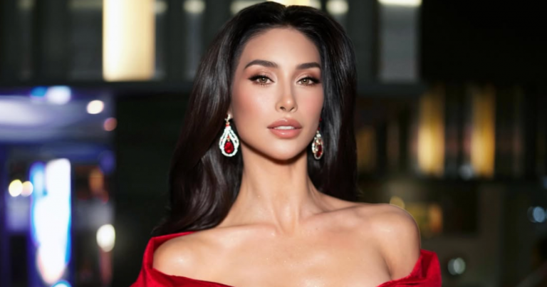 Scarlette Hermosilla reveló cómo su TDA la afectó en la final de Miss Universo Chile: 