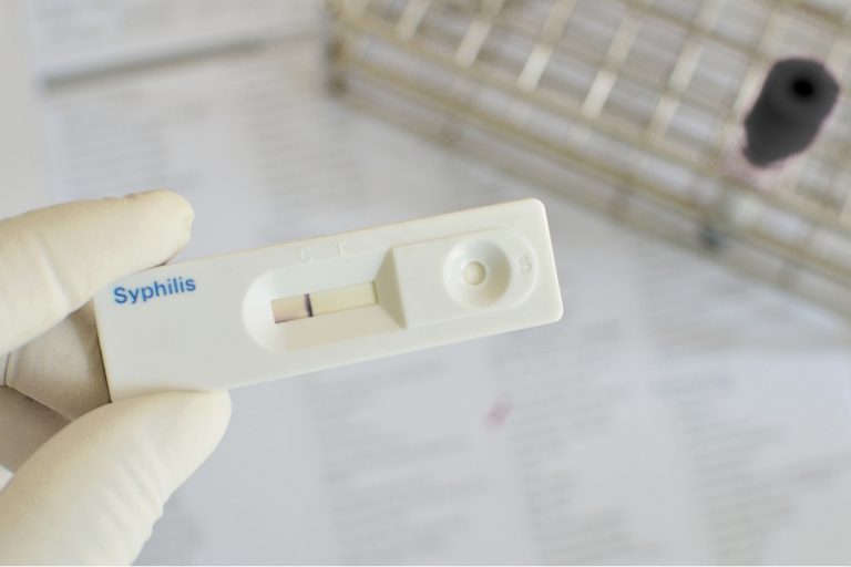 Aumento de casos de sífilis en Chile: ¿por qué afecta más a mujeres sobre 60 años?