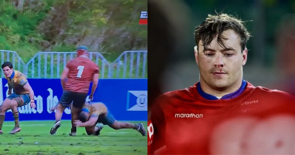 Rugbista chileno rompe el silencio tras grave lesión ante Uruguay: “Jamás este deporte debe aceptar ese nivel de alevosía”