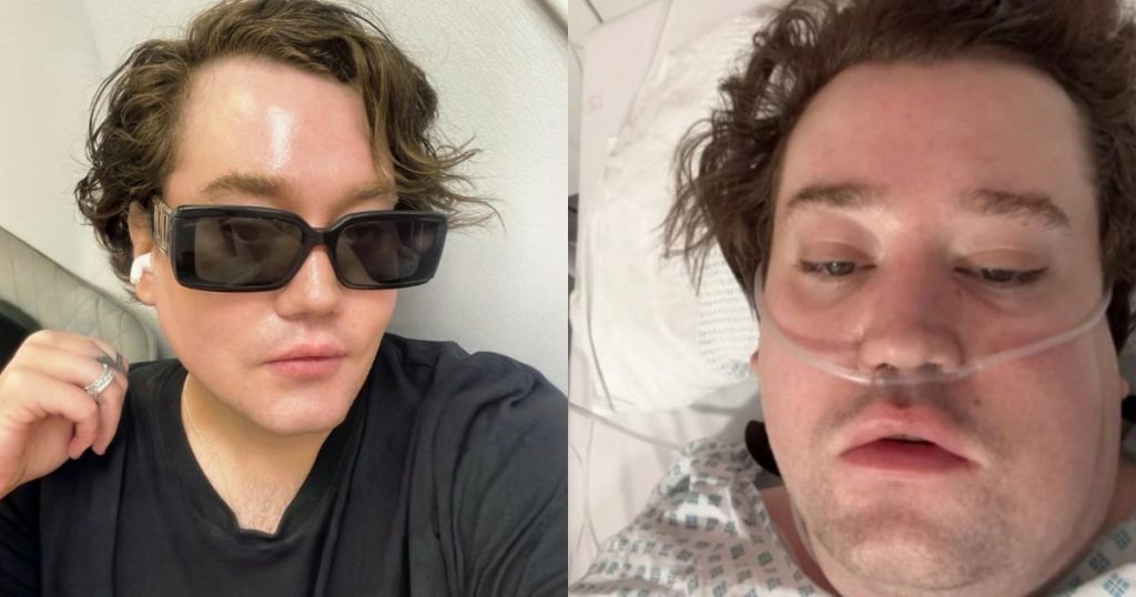“Estoy contento con la vida que tuve”: Nico Yunge preocupa desde hospital en Londres