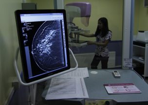 Presidente de SCOM y la importancia de tratar a tiempo el cáncer de mama: 