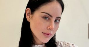 Ignacia Michelson anuncia nueva cirugía estética tras 13 años: “Estamos buscando la naturalidad”
