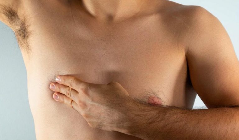 Cáncer de mama en hombres: cómo reconocer sus síntomas y qué aumenta el riesgo de padecerlo